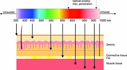 Penetration depth of laser into the skin